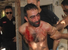 Aranan şahıs polisi bıçakladı